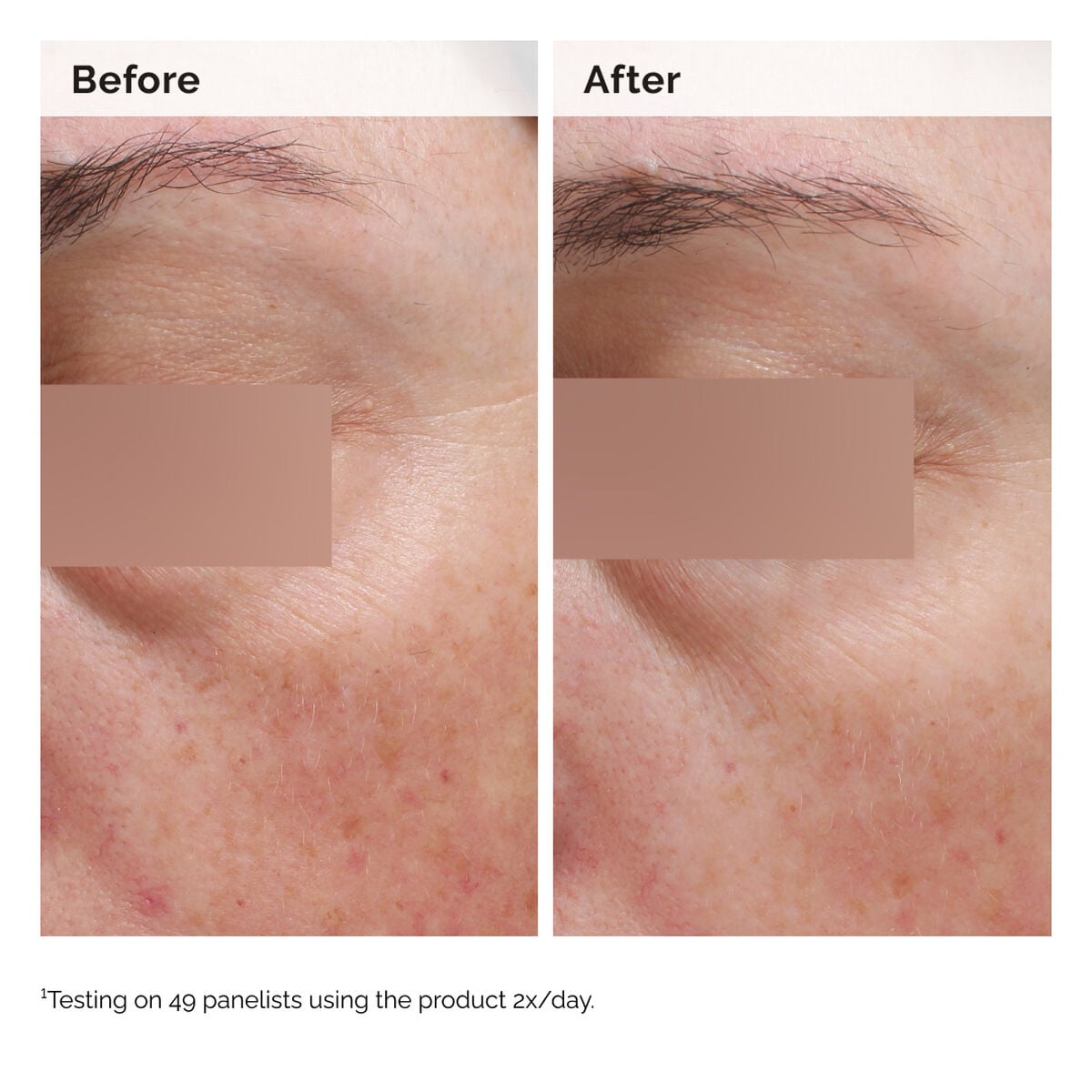 niacinamide-5-face-and-body-emulsion-q0 2024-08-23-ORD-Nia-5pct-Face-Body-B-A-Elasticity-Global-02-1x1.jpg