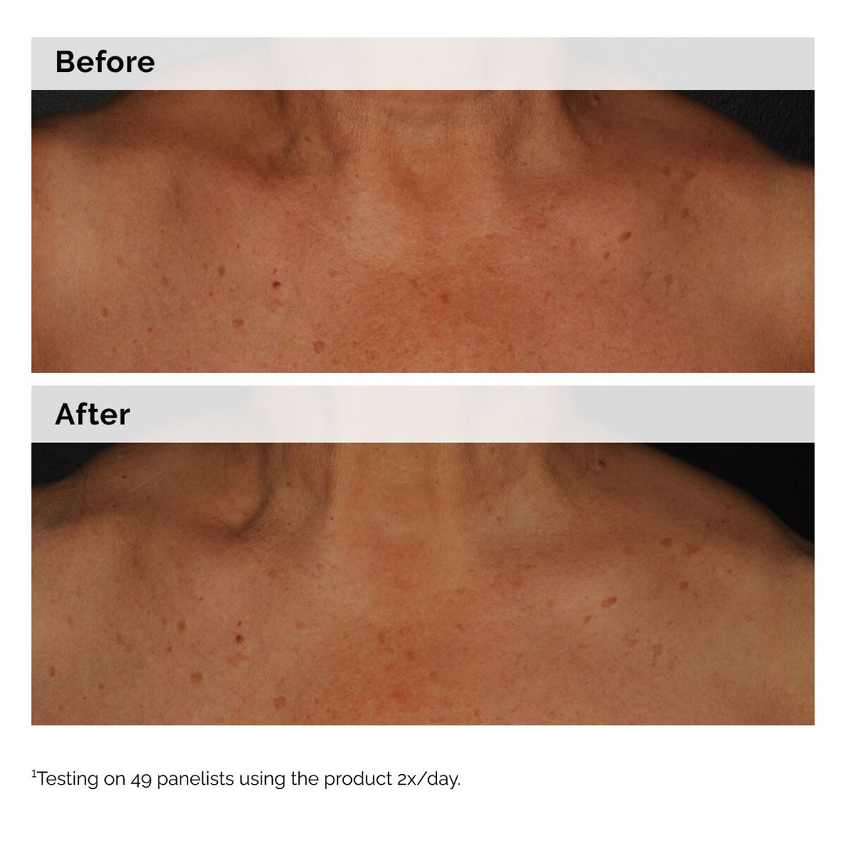 niacinamide-5-face-and-body-emulsion-q0 2024-08-23-ORD-Nia-5pct-Face-Body-B-A-Global-02-1x1.jpg