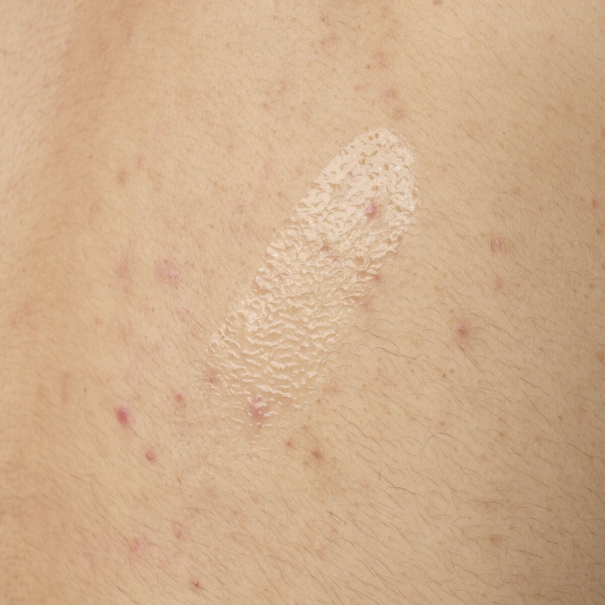 salicylic-acid-0-5-body-serum-w1 ORD-salicylic-acid-05-body-240ml-application.jpg