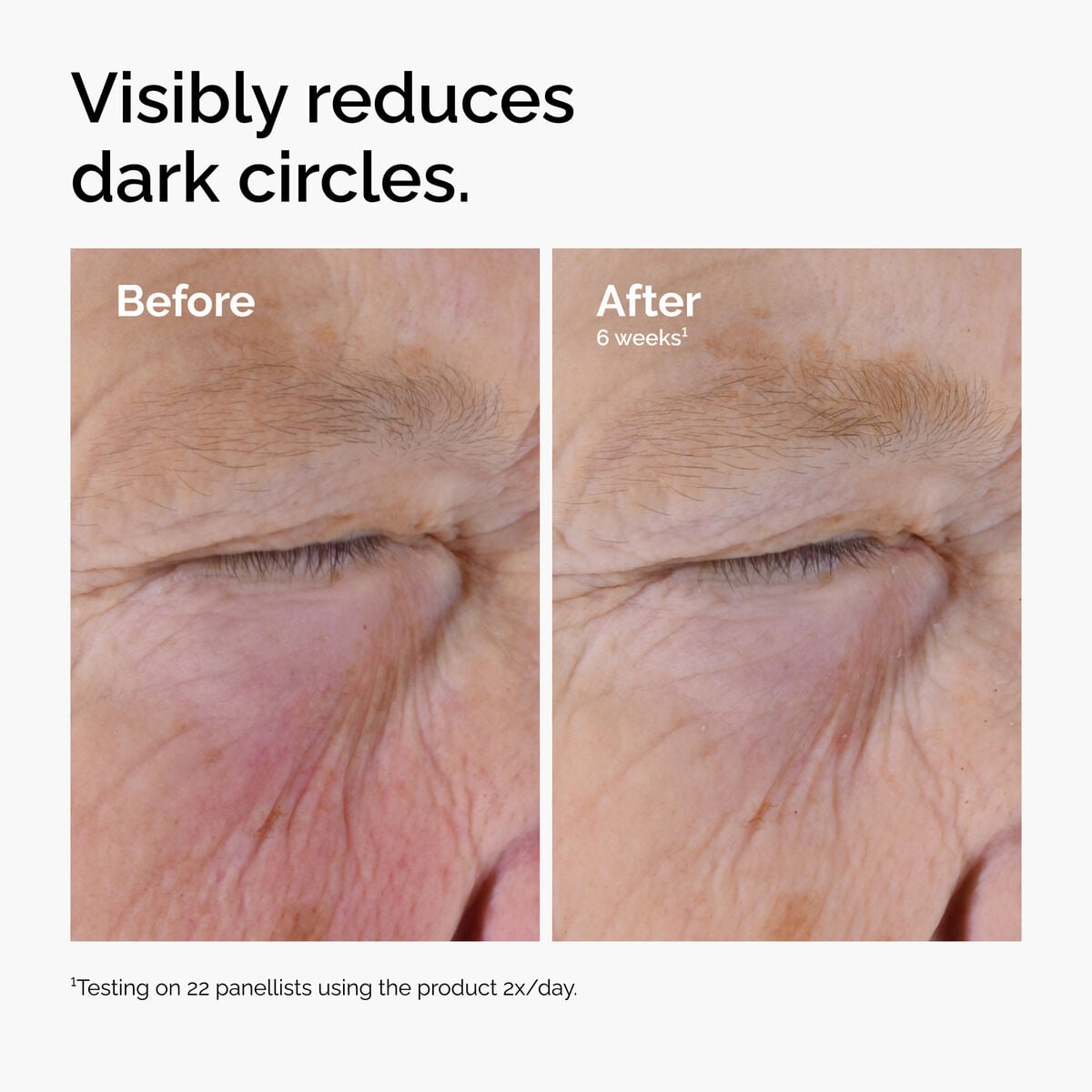 caffeine-solution-5-egcg-eye-serum-g5 ord-caffeine-solution-egcg-dark-circles-before-after.jpg