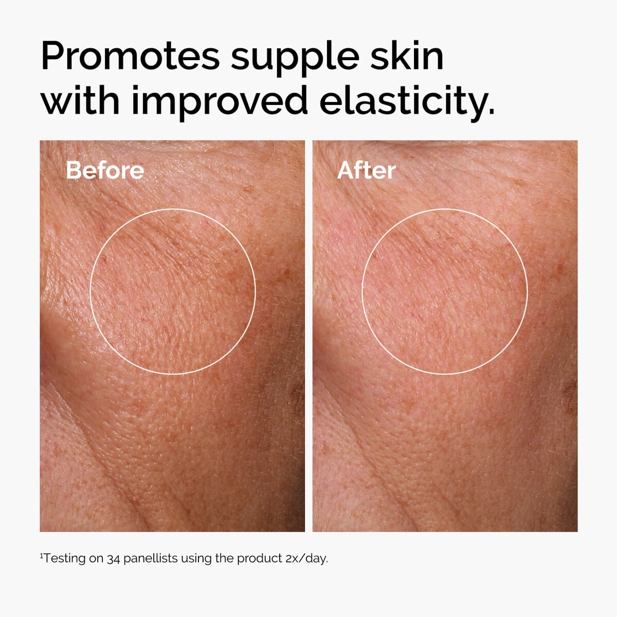 hyaluronic-acid-2-b5-with-ceramides-n6 ord-hyaluronic-acid-2pct-b5-hydrating-serum-before-after-elasticity.jpg