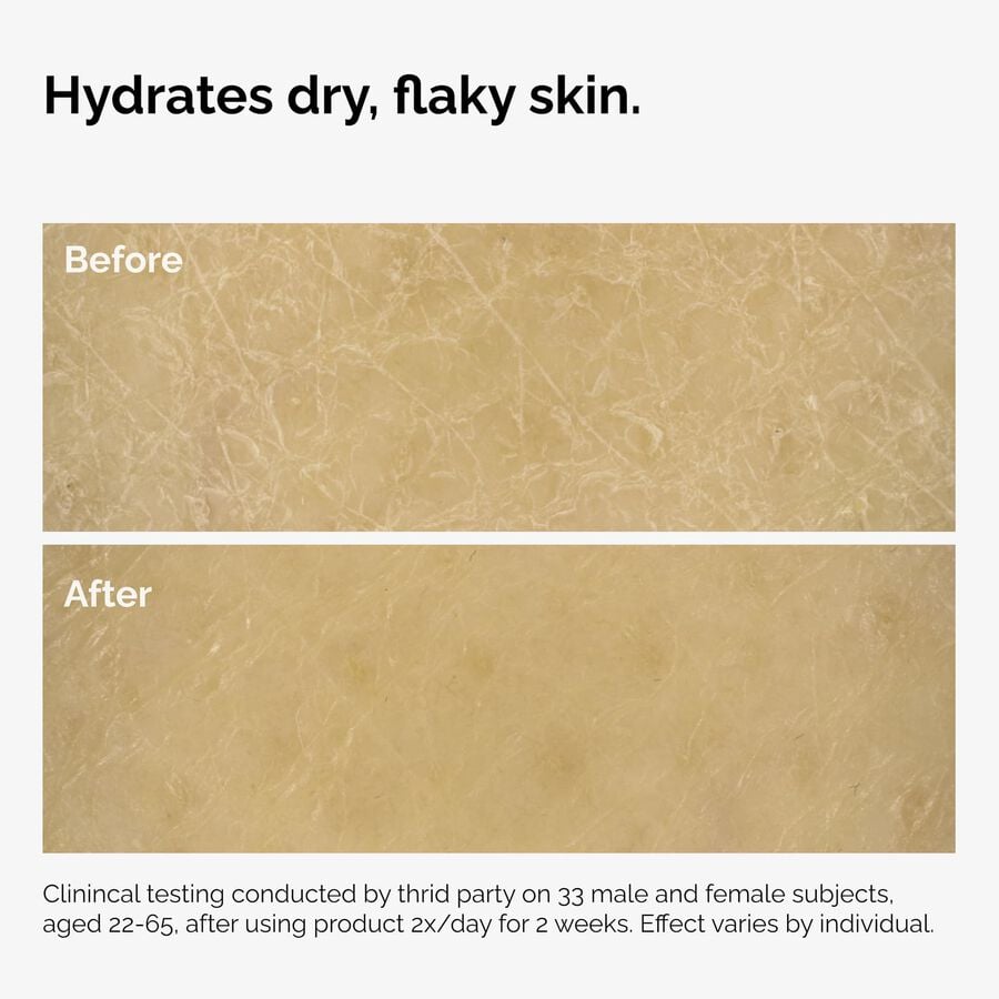the-body-care-collection-i9 ord-natural-moisturizing-factors-inulin-body-before-after-graphic-02.jpg