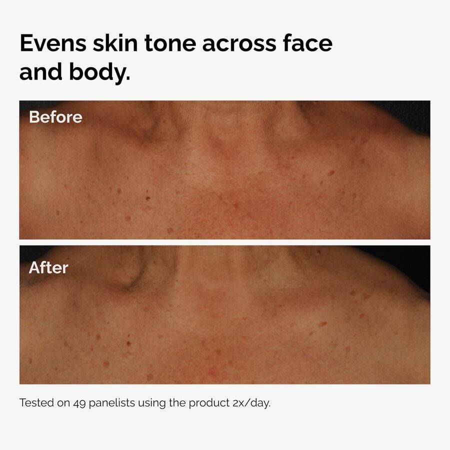 the-body-care-collection-i9 ord-niacinamide-face-body-serum-before-after-even-tone-graphic.jpg