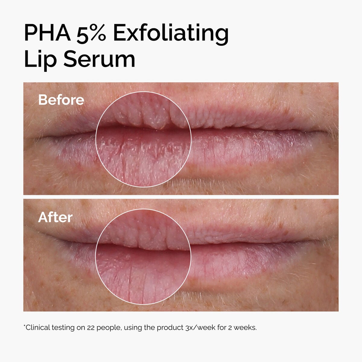 pha-5-exfoliating-lip-serum-o9 ord-pha-5pct-lip-exfoliating-serum-before-after.jpg
