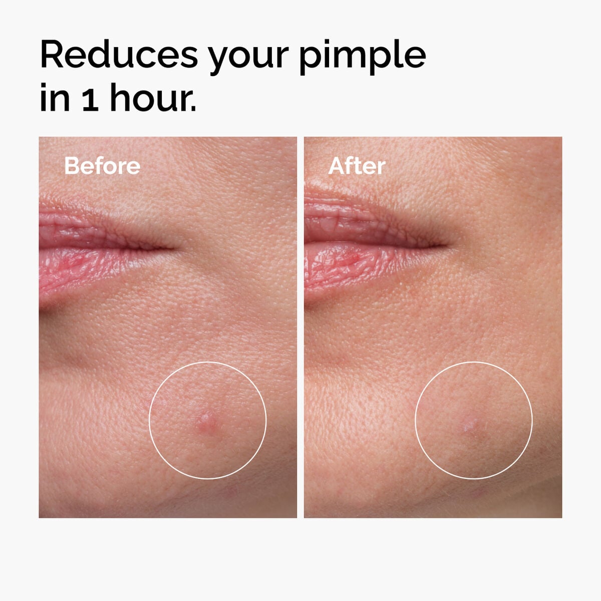 sulfur-10-powder-to-cream-concentrate-a3 ord-sulfur-10pct-powder-to-cream-concentrate-before-after-NA.jpg