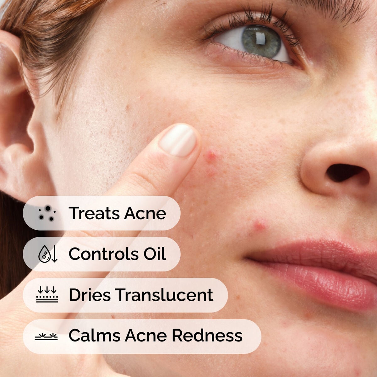 sulfur-10-powder-to-cream-concentrate-a3 ord-sulfur-10pct-powder-to-cream-concentrate-model-application-with-benefits-acne.jpg